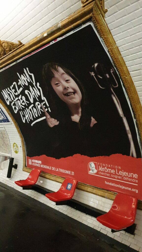 Down Syndrome
